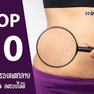 10 อันดับ ครีมลดรอยแตกลาย ยี่ห้อไหนดี ปี 2021