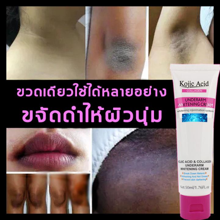 รักษาใกล้ชิด บอกลากับสีดำ ใช้ใด้ทั่งร่างกาย GUANJINGครีมทาใต้วงแขน kojic acid ครีมทาขาหนีบดำ ครีมทาแก้คอดำ ครีมทารักแร้ดำ คริมทาผิวขาว ครีมทาจักแร้ดำ ผิวขาวเร่งด่วน รักษารักแร้ดำ ครีมทาผิวขาว คนีมทาผิวขาว ครีมผิวขาว ครีม ทา ผิว ขาว ครีมทาก้นขาว