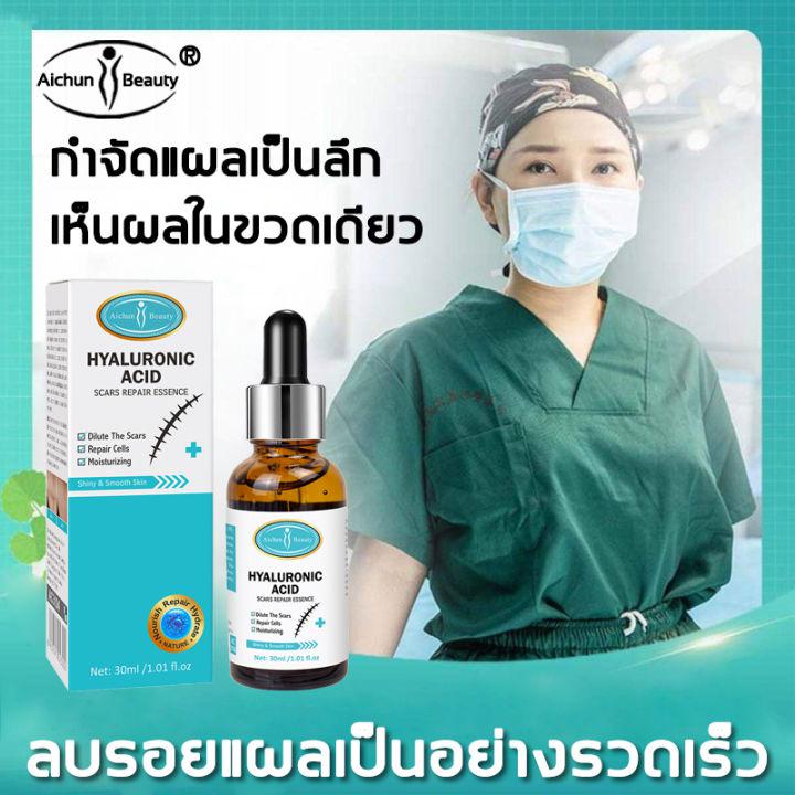 ลบรอยแผลเป็นจากยุงกัด!AICHUNครีมลดรอยแผลเป็น ทาแผลเป็น แผลเป็น ครีมรอยแผลเป็น ทาคีลอยด์ ทาลอยแผลเป็น ทารอยแผลเป็น ครีมทาแผลนูน เจลทารอยแผลเป็น