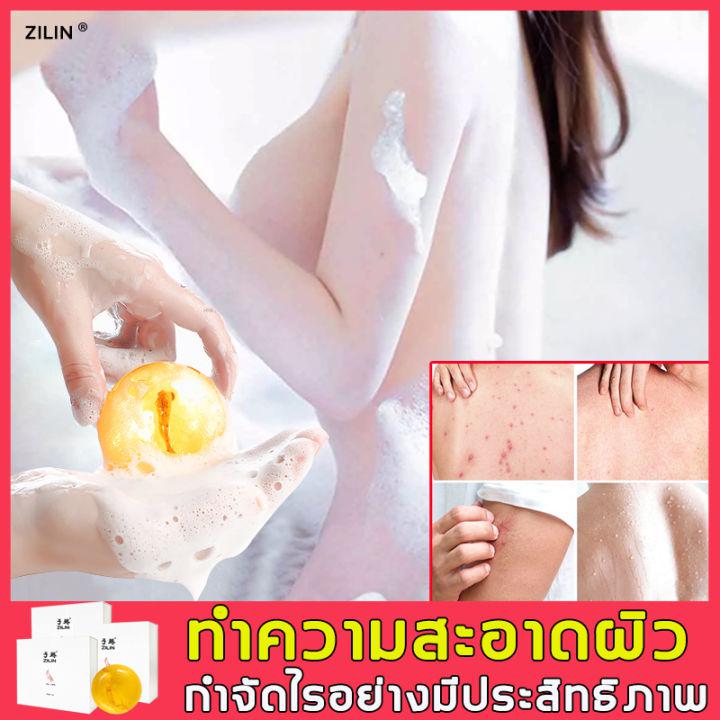 สบู่ผิวขาวถาวร ZILIN สบู่ลดรอยสิว 100g สบู่ลดสิวหน้า สบู่รักษาสิว ใช้ได้ทั้งตัว สบู่กำจัดสิว สบู่ลดสิว สบู่ลดสิวหลัง สบู่กำจัดไร  สบู่ล้างหน้า สบู่ขัดผิวขาว สบู่ฆ่าเชื้อ สบู่ก้อน สบู่หน้าขาวใส สบู่โสม สบู่สูตรลับ สบู่สิวที่หลัง สบู่อาบน้ำ