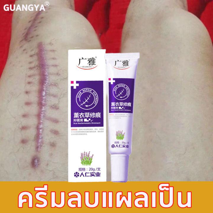 ✨จัดส่งสินค้าจากไทย✨ครีมลบแผลเป็น ครีมทาแผลเป็น ครีมแก้ขาลาย ครีมลดรอยแผลเป็น ครีมลบรอยแผลดำ ครีมรักษาแผลเป็น เจลลบรอยแผลเป็น ครีมลดแผลเป็น ครีมกำจัดรอยแผลเป็น ครีมลบรอยแผลเป็น ครีมทาลบรอยแผล ครีมลดรอยแผลดำ ครีมทารอยแผลเป็น ครีมทาแผลรอยดำ