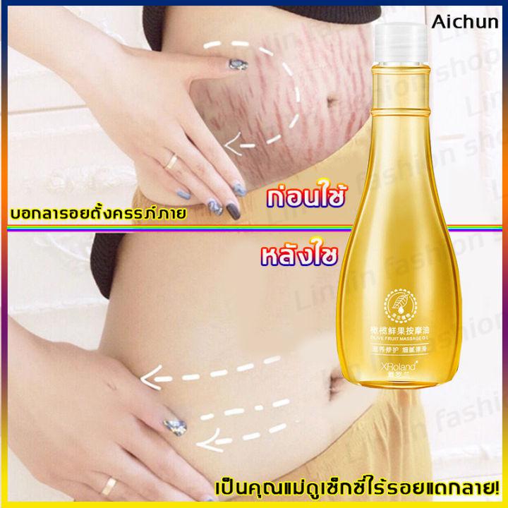 ใช้ได้ทั้งรอยแตกลายใหม่และเก่า Aichun 150ml ครีมทาแตกลาย เป็นคุณแม่ดูเซ็กซี่ไร้รอยแตกลาย! ครีมทาท้องลาย ครีมแก้ท้องลาย ครีมหน้าท้องแตกลาย ลดผิวแตกลาย ครีมทาหน้าท้อง โลชั่นท้องลาย ลบรอยแตกลาย ครีมลดรอยแตกลาย ครีมทาท้อง ท้องลาย ลดรอยแตกลาย รอยแตกลาย