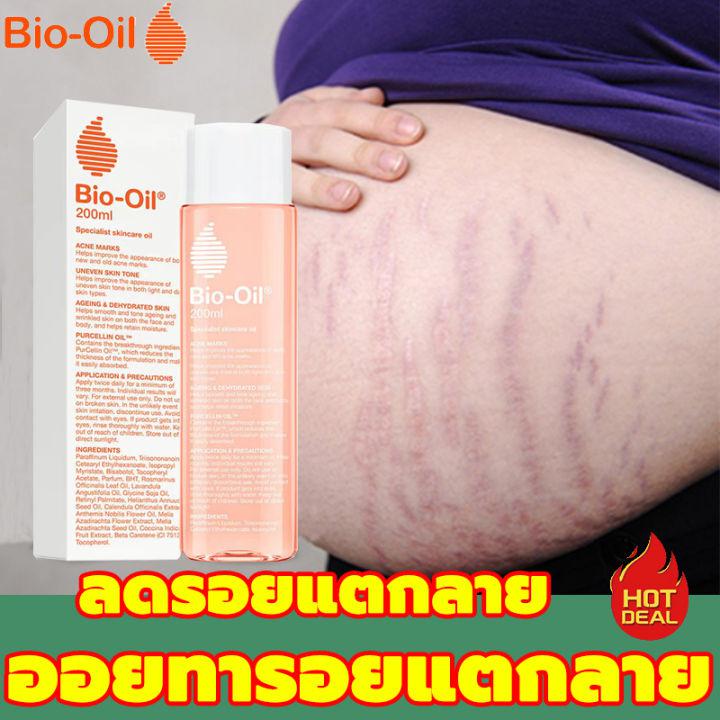 🚚จัดส่งที่รวดเร็ว🚚 Bio Oil ไบโอ ออยล์ [200 ml.] ฟื้นฟูผิว รอยแตกลาย ขนาด ลดเลือนรอยแผลเป็น ผิวแตกลาย ให้ดูจางลง ครีมลดรอยแตกลาย ครีมแก้ท้องลาย ลดการแตกลาย ครีมกันแตกลาย body oil skincare oil