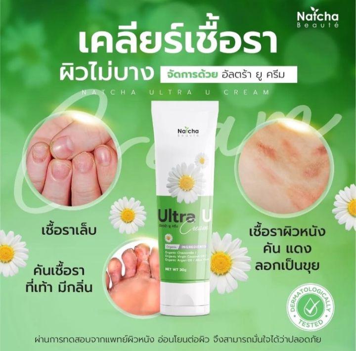 ส่งฟรี!! รอยดำยุงกัดหายได้!!! Ultra U อัลตร้ายู ครีมทาสะเก็ดเงิน กลาก เกลื้อน น้ำกัดเท้า เชื้อราผิวหนัง