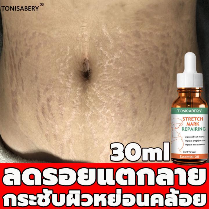 ครีมทาแตกลาย 30ml ครีมลดลอยเเตก ริ้วรอยเรียบเนียน ซ่อมแซมท้อง ครีมทาขาแตกลาย ครีมทาท้องลาย ครีมทาก้นดำลาย ครีมทาขาลาย ครีมทาผิว คลีม ลดผิวแตกลาย แก้แตกลายลาย ผิวลาย  ครีมทารอยแตกลาย ออยทารอยแตกลาย ​เซรั่มทารอยแลาย ครีมลดรอยแตกลายหลังคลอด ยกกระชับ